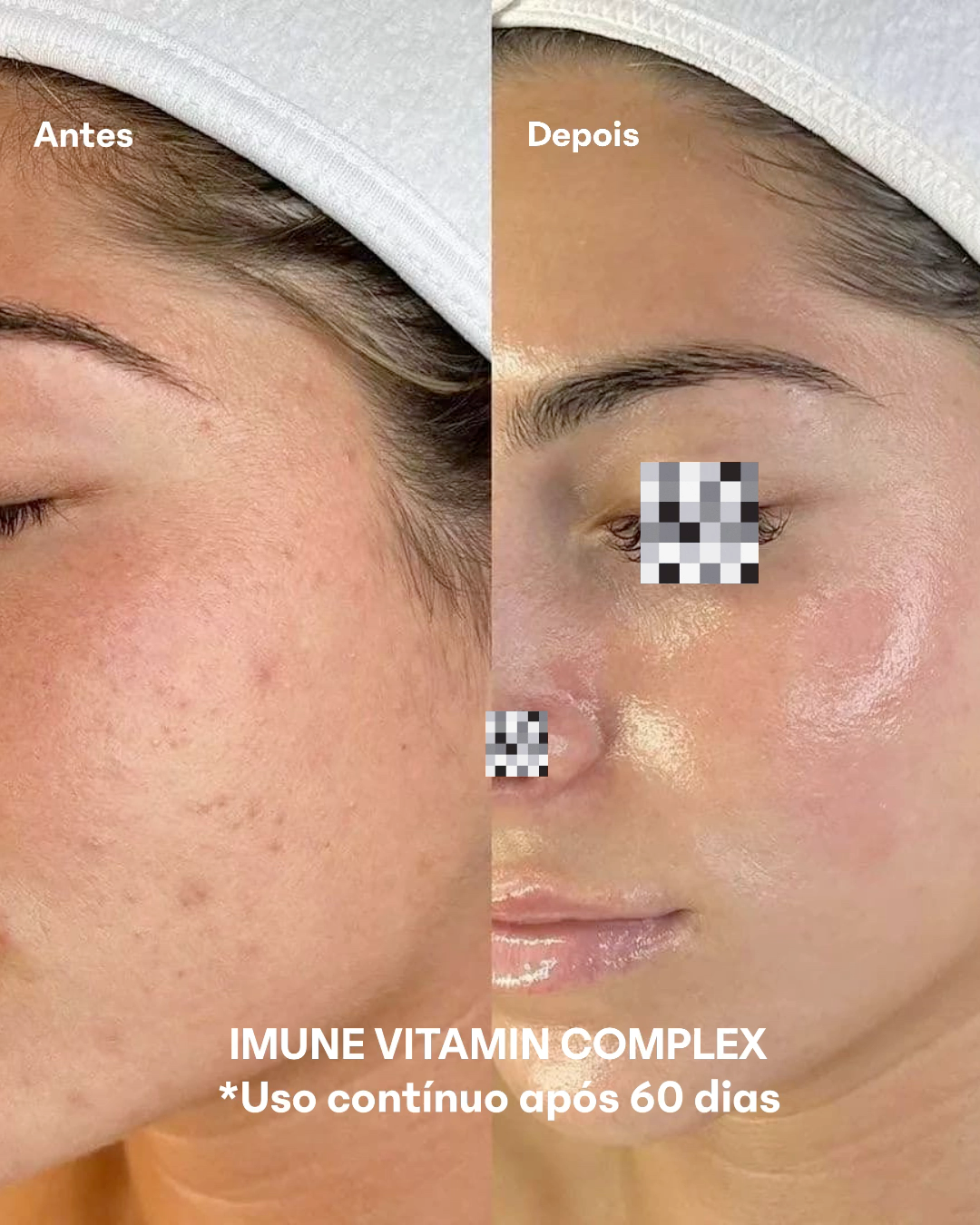 IMUNE VITAMIN COMPLEX